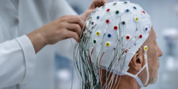 CervoMed prices $10M direct stock offering